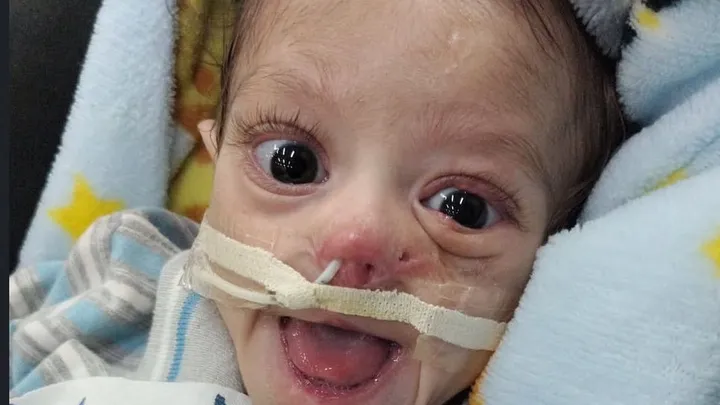 Ma fille d'un an confrontée à une cardiopathie congénitale (CDH)